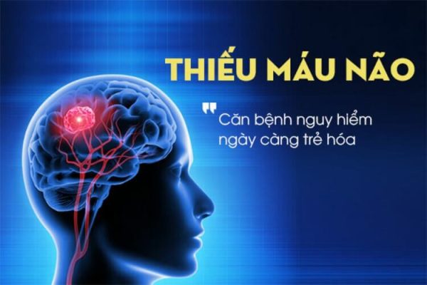 Thiếu máu lên não phải làm sao? Cách điều trị thiếu máu não hiệu quả