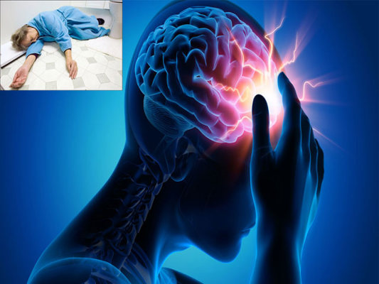Tại sao bị thiếu máu não? Nguyên nhân thiếu máu não và các yếu tố nguy cơ